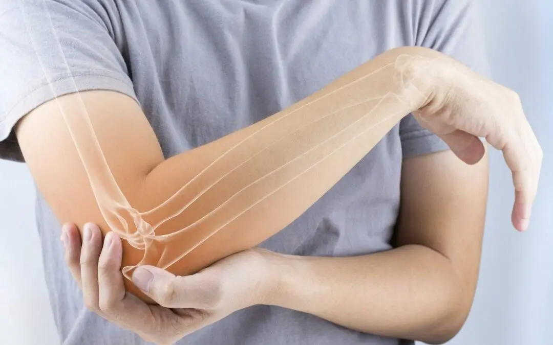 Jayden Daniels’ Elbow Dislocation: Causes & Treatment