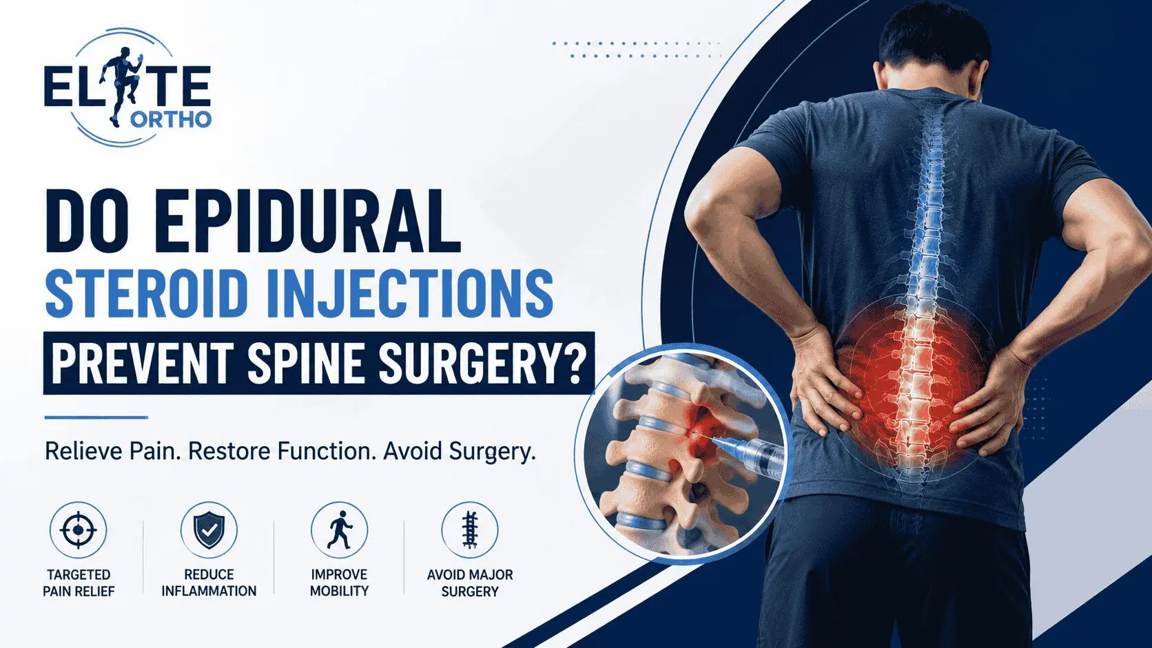 Steroid injections