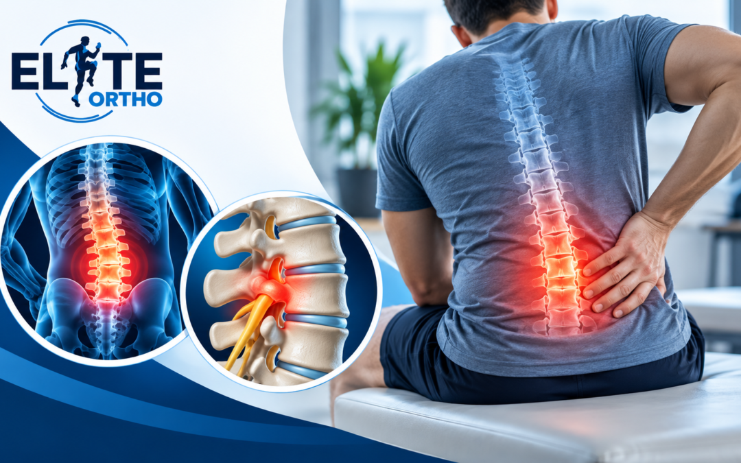 Back Pain Specialist in Gaithersburg, MD: When Should You See One?