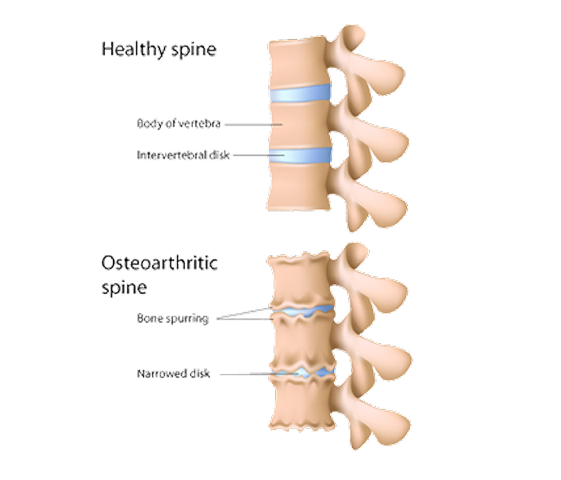 Elite Ortho Maryland (12) Spine