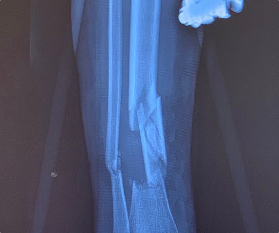 leg
