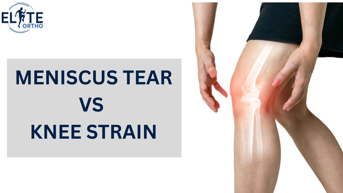 knee Meniscus Tear vs Knee Strain